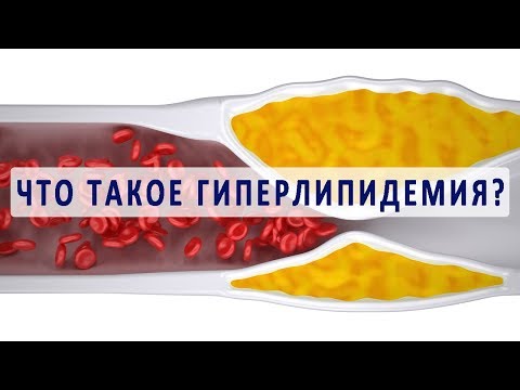 Видео о препарате Гемфиброзил Италия 600мг №30